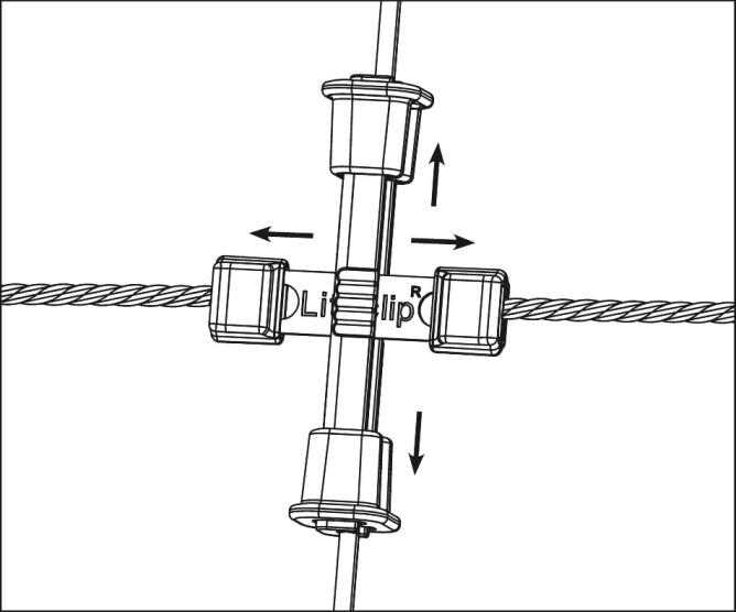 Litzclip Reparaturset f. Vertikalstreben